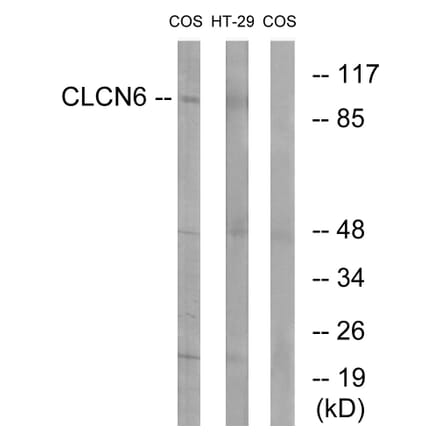 Western Blot - Anti-CLCN6 Antibody (C15081) - Antibodies.com