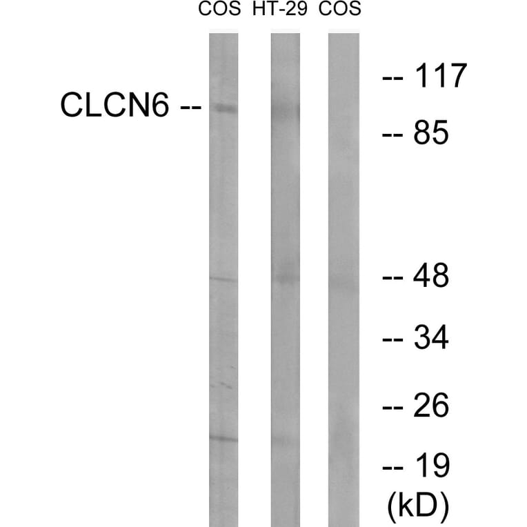 Western Blot - Anti-CLCN6 Antibody (C15081) - Antibodies.com