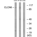 Western Blot - Anti-CLCN6 Antibody (C15081) - Antibodies.com