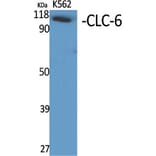 Western Blot - Anti-CLCN6 Antibody (C15081) - Antibodies.com