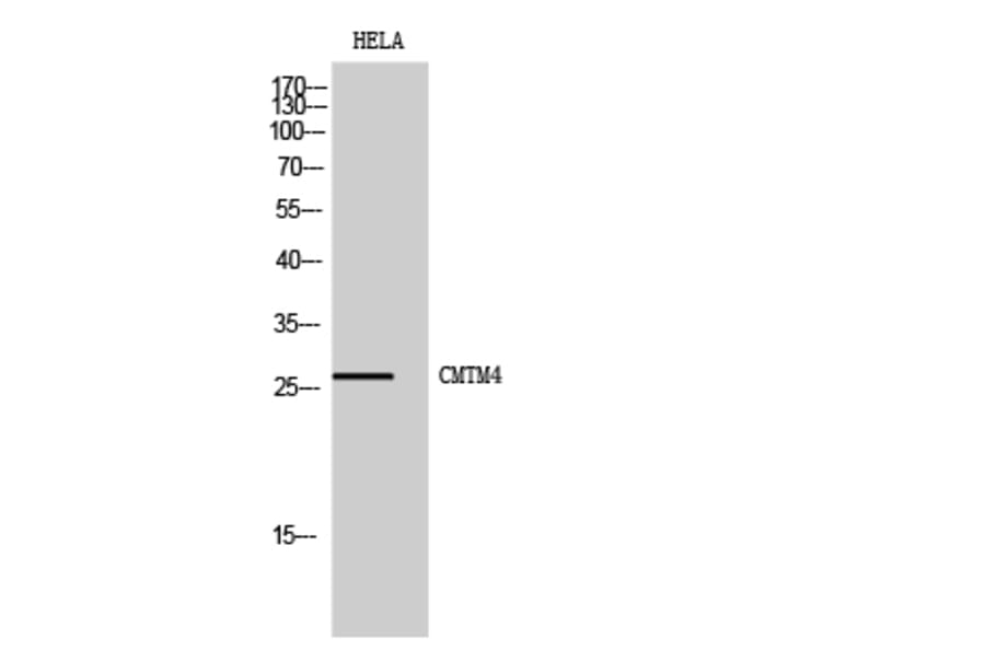 Western Blot - Anti-CKLF4 Antibody (C15134) - Antibodies.com
