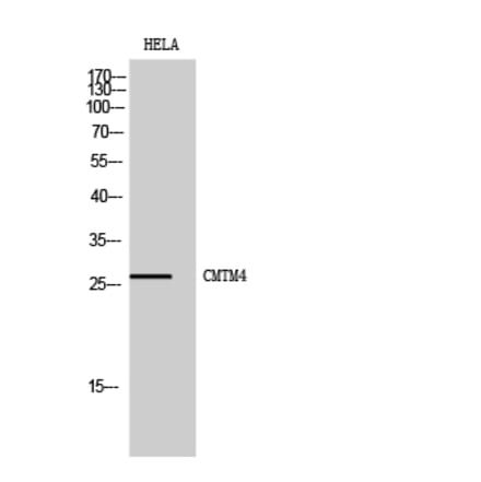 Western Blot - Anti-CKLF4 Antibody (C15134) - Antibodies.com