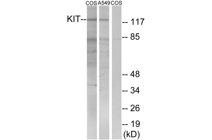 Western Blot - Anti-c-Kit Antibody (B7138) - Antibodies.com