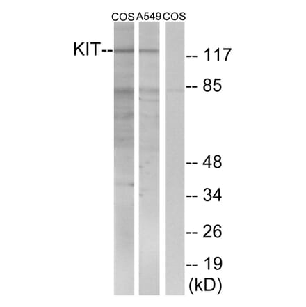 Western Blot - Anti-c-Kit Antibody (B7138) - Antibodies.com
