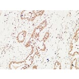 Immunohistochemistry - Anti-c-Kit Antibody (B7138) - Antibodies.com