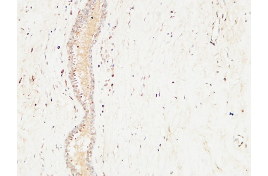 Immunohistochemistry - Anti-c-Kit Antibody (B7138) - Antibodies.com