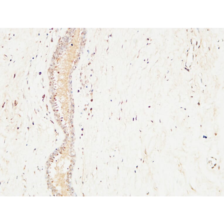 Immunohistochemistry - Anti-c-Kit Antibody (B7138) - Antibodies.com