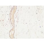 Immunohistochemistry - Anti-c-Kit Antibody (B7138) - Antibodies.com