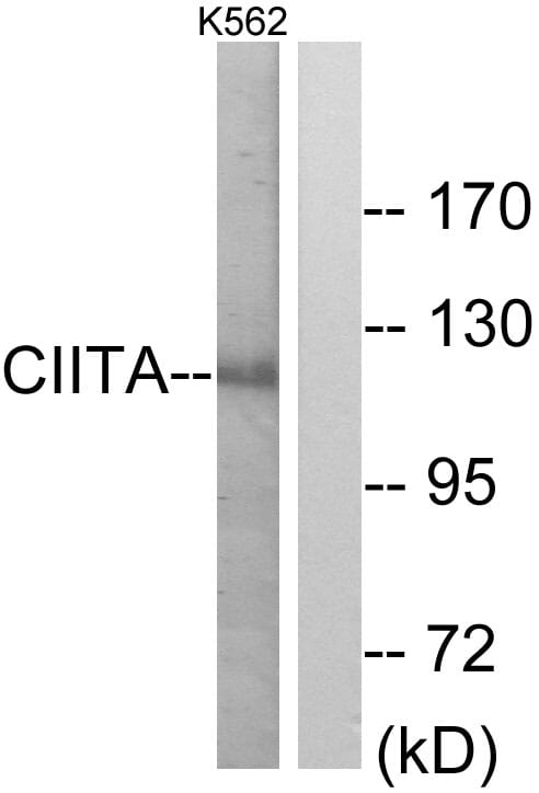 Western blot analysis of lysates from K562 cells using Anti-CIITA Antibody. The right hand lane represents a negative control, where the antibody is blocked by the immunising peptide.