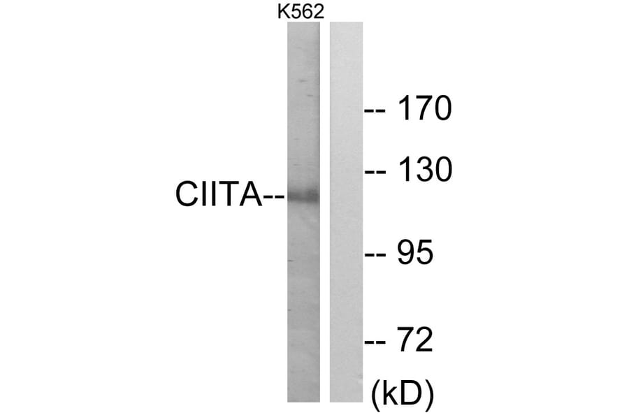 Western Blot - Anti-CIITA Antibody (C10541) - Antibodies.com