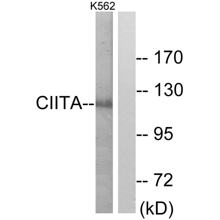 Western Blot - Anti-CIITA Antibody (C10541) - Antibodies.com