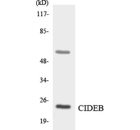 Western Blot - Anti-CIDEB Antibody (R12-2620) - Antibodies.com