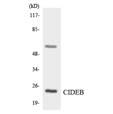 Western Blot - Anti-CIDEB Antibody (R12-2620) - Antibodies.com