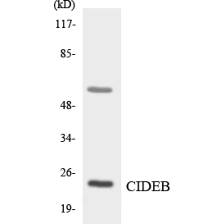 Western Blot - Anti-CIDEB Antibody (R12-2620) - Antibodies.com