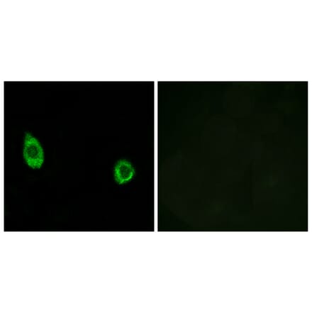 Immunofluorescence - Anti-CHST9 Antibody (C14932) - Antibodies.com