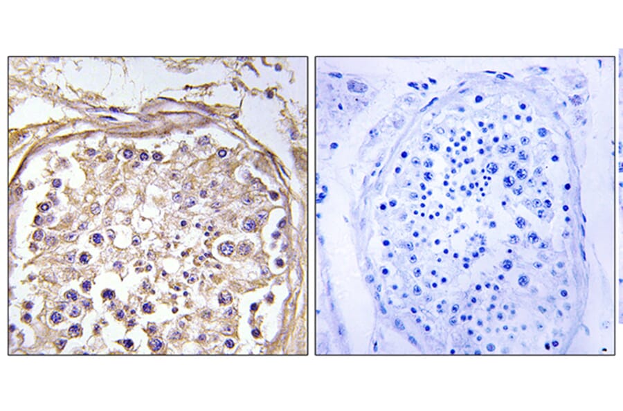 Immunohistochemistry - Anti-CHST9 Antibody (C14932) - Antibodies.com
