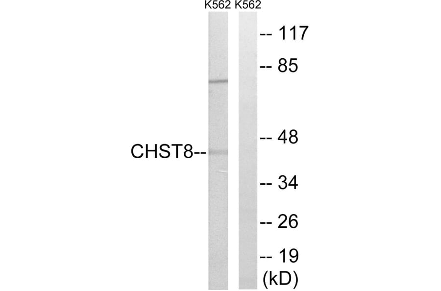 Western Blot - Anti-CHST8 Antibody (C14931) - Antibodies.com