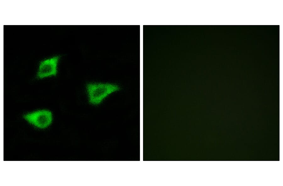 Immunofluorescence - Anti-CHRM4 Antibody (G208) - Antibodies.com