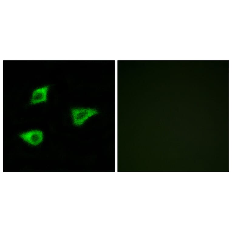 Immunofluorescence - Anti-CHRM4 Antibody (G208) - Antibodies.com