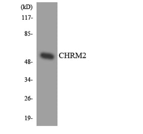 Western Blot - Anti-CHRM2 Antibody (R12-2615) - Antibodies.com