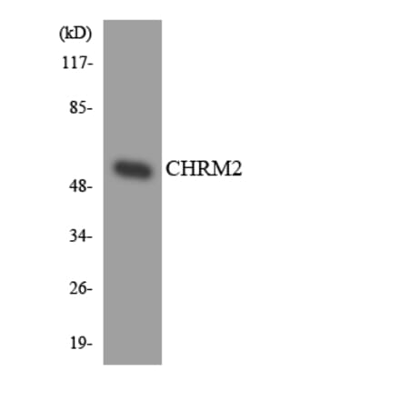 Western Blot - Anti-CHRM2 Antibody (R12-2615) - Antibodies.com