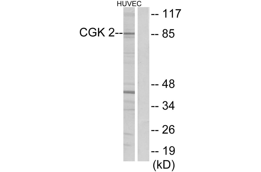 Western Blot - Anti-CGK 2 Antibody (C10961) - Antibodies.com