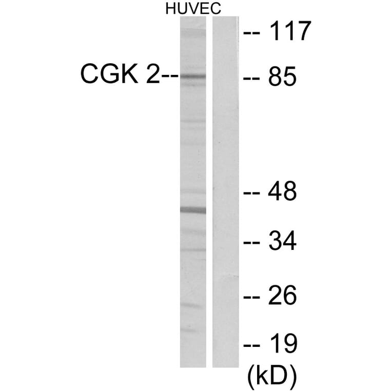Western Blot - Anti-CGK 2 Antibody (C10961) - Antibodies.com