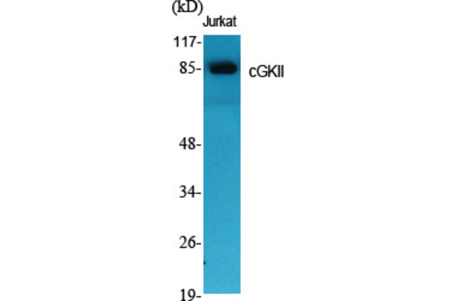 Western Blot - Anti-CGK 2 Antibody (C10961) - Antibodies.com