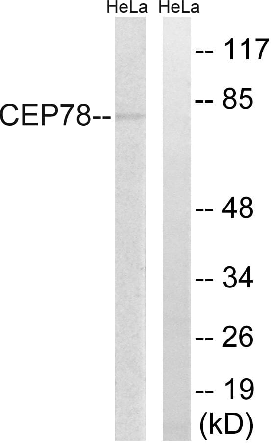 Western blot analysis of lysates from HeLa cells using Anti-CEP78 Antibody. The right hand lane represents a negative control, where the antibody is blocked by the immunising peptide.