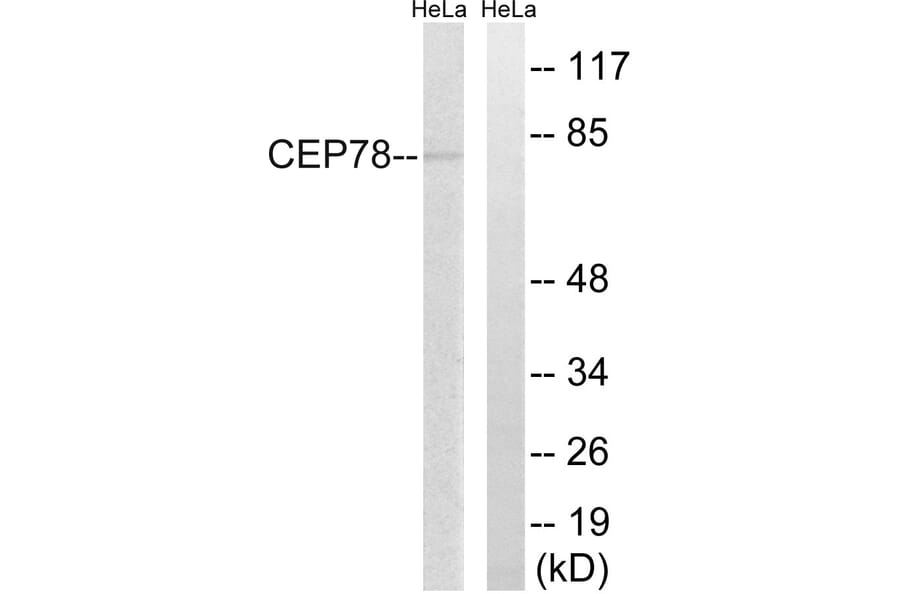 Western Blot - Anti-CEP78 Antibody (C15050) - Antibodies.com