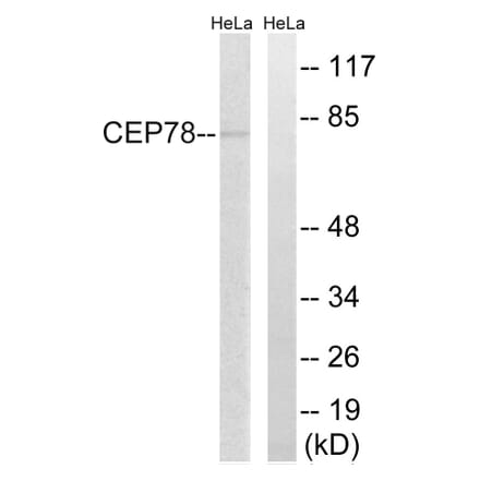 Western Blot - Anti-CEP78 Antibody (C15050) - Antibodies.com