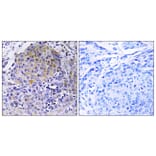 Immunohistochemistry - Anti-CEP78 Antibody (C15050) - Antibodies.com