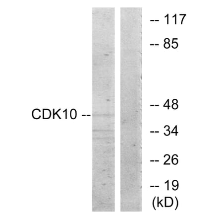 Western Blot - Anti-CDK10 Antibody (C11066) - Antibodies.com