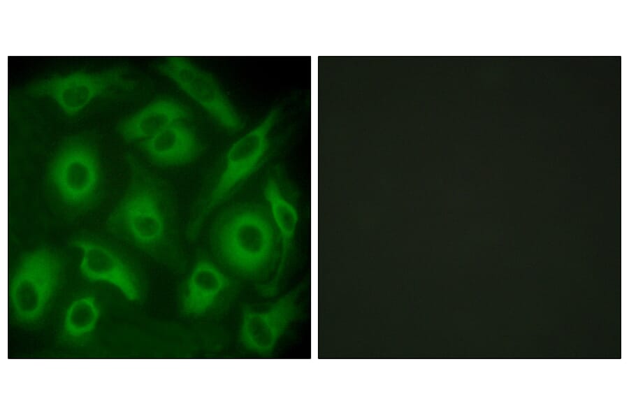 Immunofluorescence - Anti-CDH23 Antibody (C12097) - Antibodies.com