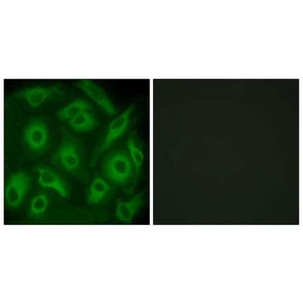 Immunofluorescence - Anti-CDH23 Antibody (C12097) - Antibodies.com