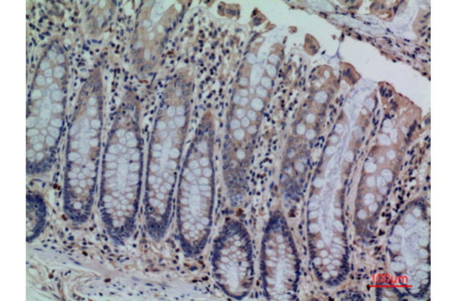 Immunohistochemistry - Anti-CDCP1 Antibody (C30583) - Antibodies.com