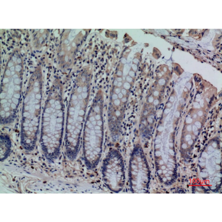 Immunohistochemistry - Anti-CDCP1 Antibody (C30583) - Antibodies.com