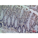 Immunohistochemistry - Anti-CDCP1 Antibody (C30583) - Antibodies.com