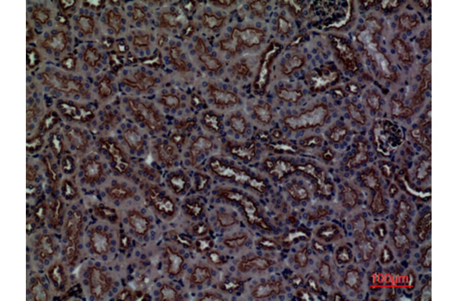 Immunohistochemistry - Anti-CDCP1 Antibody (C30583) - Antibodies.com