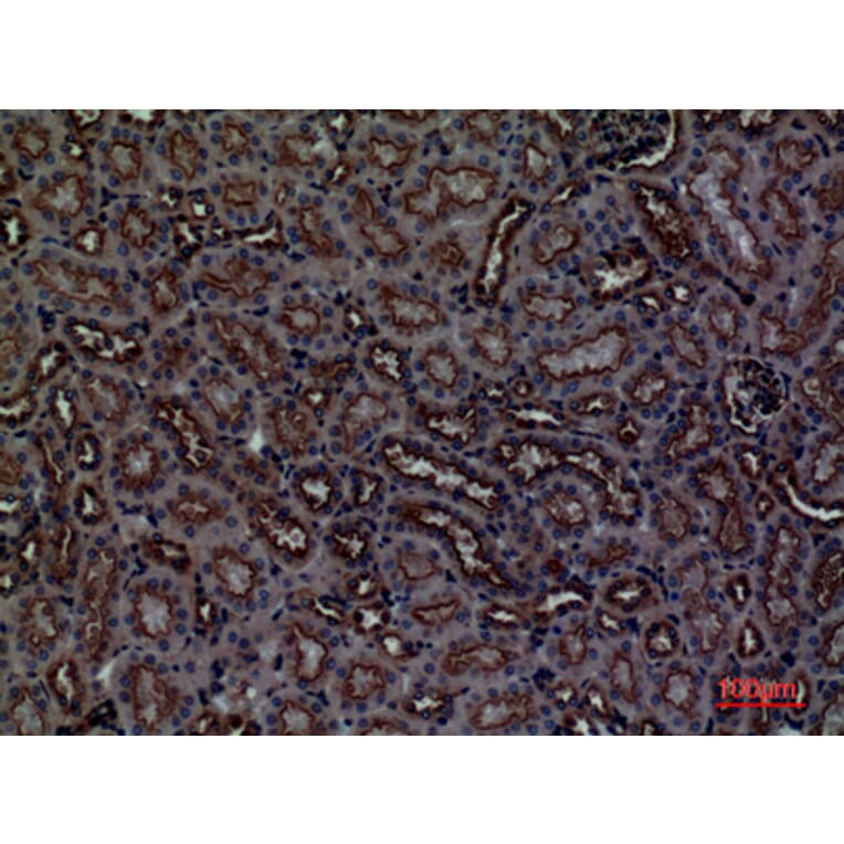Immunohistochemistry - Anti-CDCP1 Antibody (C30583) - Antibodies.com