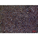 Immunohistochemistry - Anti-CDCP1 Antibody (C30583) - Antibodies.com