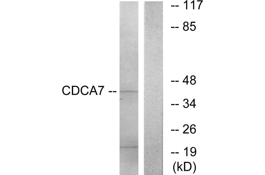 Western Blot - Anti-CDCA7 Antibody (C12176) - Antibodies.com
