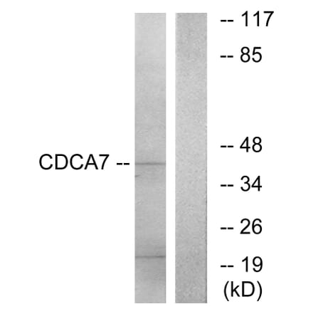 Western Blot - Anti-CDCA7 Antibody (C12176) - Antibodies.com