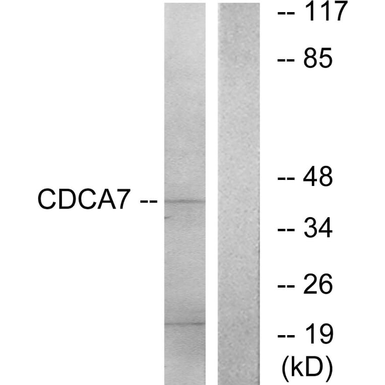 Western Blot - Anti-CDCA7 Antibody (C12176) - Antibodies.com