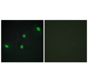 Immunofluorescence - Anti-CDCA4 Antibody (C12175) - Antibodies.com