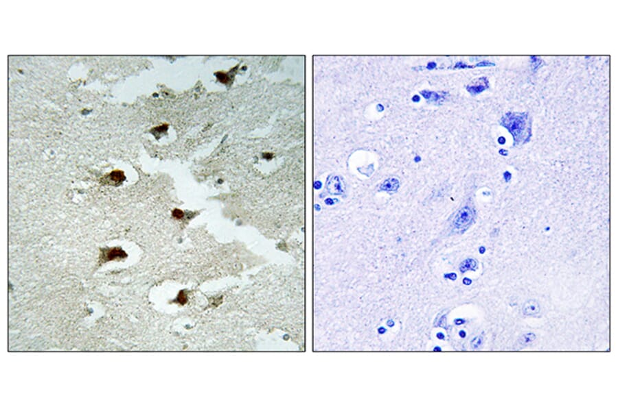 Immunohistochemistry - Anti-CDCA4 Antibody (C12175) - Antibodies.com