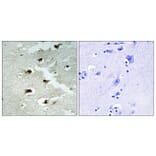 Immunohistochemistry - Anti-CDCA4 Antibody (C12175) - Antibodies.com