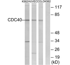 Western Blot - Anti-CDC40 Antibody (C17847) - Antibodies.com