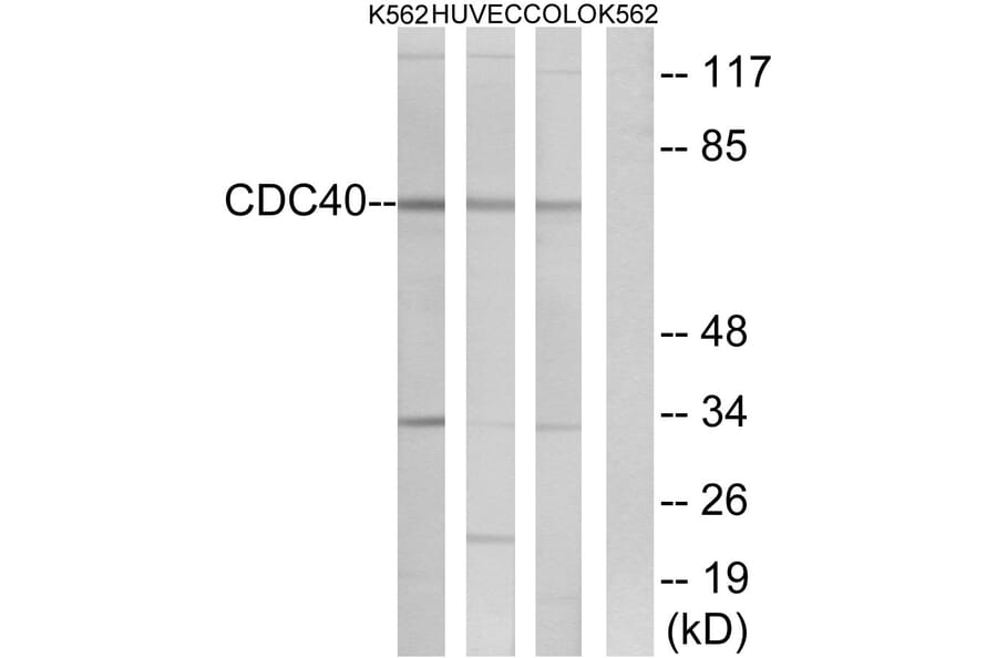 Western Blot - Anti-CDC40 Antibody (C17847) - Antibodies.com