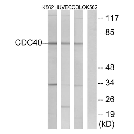 Western Blot - Anti-CDC40 Antibody (C17847) - Antibodies.com